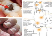 ეს სასიკვდილო შხამი თქვენს ორგანიზმშია! რა უნდა ვიცოდეთ მის შესახებ? ყურადსაღებია