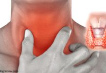 რჩევები, თუ როგორ უნდა მოიშოროთ ეფექტურად ფარისებრი ჯირკვლის პრობლემები!!