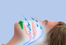 ამ რჩევების დახმარებით ხვრინვას სამუდამოდ დაივიწყებთ