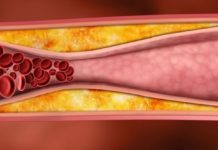 ამ სასმელს ექიმები მაღალი ქოლესტერინის მქონდე პაციენტებს ურჩევენ! ის ცხიმებსაც წვავს!