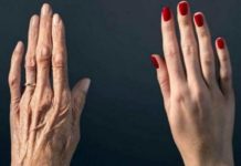 ამ 46 წლის ქალბატონის ხელები გამოყურებოდა ისე როგორც 70 წლის ასაკში, მაგრამ როდესაც ამ საიდუმლო რეცეფტის გამოყენება დაიწყო, ვეღარ ცნობს მის ხელებს.