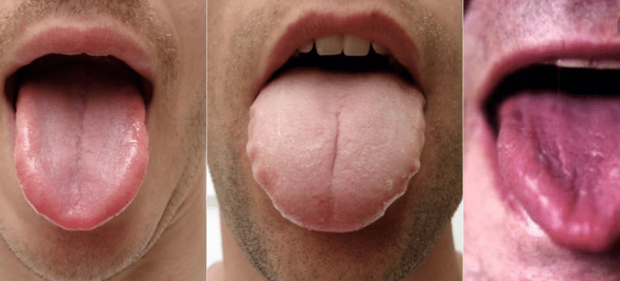 How your tongue reflects your health