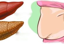 კოქტეილი, რომელიც ღვიძლს გაგიწმენდთ-ეფექტური საშუალება მომენტალური შედეგით!