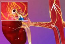 შემოგთავაზებთ იმ პროდუქტთა ჩამონათვალს, რომელთა წყალობითაც შეძლებთ არტერიული წნევის დარეგულირებას.