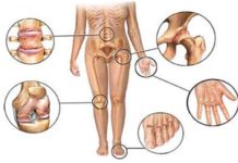 ეს შხამი ჩვენს ძვლებს ანადგურებს! თუმცა მას მაინც ყოველდღე ვსვამთ…