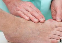 როგორ მოვიშოროთ ძვალი ფეხზე. რეცეპტი მედდა მეგობრისგან