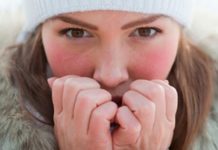 გაინტერესებთ საიდან მოდის სიცივის ალერგია და როგორ გავუმკლავდეთ მას?!