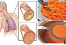 უძველესი ხალხური სიროფის რეცეპტი, რომელიც აშორებს ნახველს ფილტვებიდან და კურნავს ხველას!