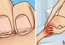 კალცის დეფიციტის 7 სიმპტომი, რომელსაც ყურადღებას არავინ აქცევს! ამის ცოდნა აუცილებელია!