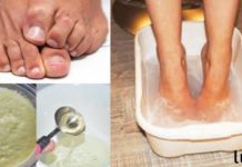 3 ეფექტური მეთოდი ფეხებიდან უსიამოვნო სუნის წინააღმდეგ. სასარგებლო ინფორმაციაა