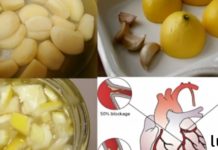 შეურიეთ ლიმონი და ნიორი ერთმანეთს, იგი იდეალური ნაზავია გულის სისხლძარღვების გასაწმენდად, სცადეთ ახლავე!