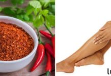 5 გზა ვარიკოზული ვენების ბუნებრივი მკურნალობისთვის