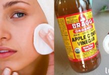 გოგონამ კანზე ვაშლის ძმარი წაისვა და თვალებს არ დაუჯერა! გირჩევთ გაიმეოროთ იგივე!