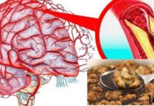 თავის ტვინის სისხლძარღვების გაწმენდის უნიკალური მეთოდები, რაზეც ექიმები დუმს