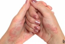 თქვენ უნდა შეწყვიტოთ ამ ხილის ქერქის გადაყრა: ის ეხმარება ფსორიაზს, ათავისუფლებს მეჭეჭებს და შეუძლია კბილების გათეთრება!