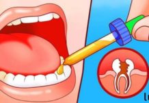 ასე მოვიშორე საკუთარი კბილის ტკივილი და გავაკვირვე ჩემი სტომატოლოგი, როცა ვუთხარი ამის შესახებ!