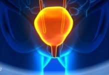 უდავოა, მილიონობით ადამიანი იტანჯება შარდის შეუკავებლობით! აქ არის 6 ბუნებრივი რომელიც დაგეხმარებათ.