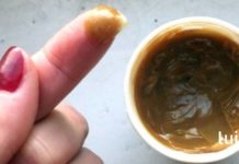 გამოიყენეთ ეს მალამო და მოიშორეთ ოსტეოქონდროზით გამოწვეული ტკივილები! შედეგი წარმოუდგენელია!