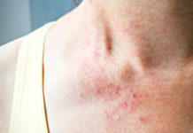 ამ 8 სიმპტომით თქვენი სხეული ცდილობს გითხრათ რაღაც ძალიან მნიშვნელოვანი. იცოდით ამის შესახებ?