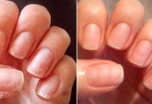 თუ შეამჩნევთ, რომ თქვენი ფრჩხილები სულ უფრო მშრალი ხდება, დაკარგა ჯანსაღი ფერი და ბზინვარება – აუცილებლად სცადეთ ეს მეთოდები!