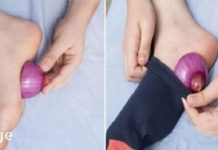 ხახვს შეუძლია განკურნოს სულ მცირე 5 ჯანმრთელობის პრობლემა!