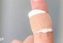 მოიშორეთ ფიბრომები და მეჭეჭები ძალიან მარტივად ექიმთან მისვლის გარეშე! ეს მეთოდი ნამდვილად მუშაობს!