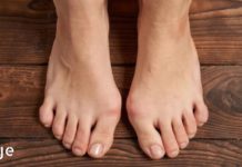 დაემშვიდობეთ პოდაგრას ამ ძლიერი ბუნებრივი სამკურნალო საშუალებებით!