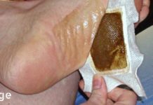 გააკეთეთ დეტოქსის საფენები სახლში და მოიშორეთ ორგანიზმიდან ყველა საშიში ტოქსინი! მისი ეფექტიურობა დადასტურებულია!