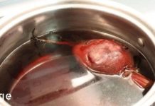 ეს სამუდამოდ აღმოფხვრის ბუასილს 5 დღეში! ჩვენი წინაპრებისგან ნასწავლი სამკურნალო საშუალება!