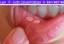 შესანიშნავი ხალხური მეთოდი სტომატიტისგან თავის დასაღწევად!