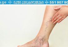 მოიშორეთ ვარიკოზული ვენები ამ საოცარი წვენით! venebi