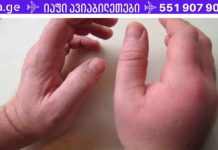 თითები და ხელები გიშუპდებათ? აქ არის მისი გამომწვევი რამდენიმე მიზეზი! xelebis da titebis sheshupeba
