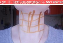 იოდის ბადე: მარტივი ხაზების უდიდესი სამკურნალო ძალა! ეს რომ აქამდე მცოდნოდა, უამრავ დაავადებას ავირიდებდი!