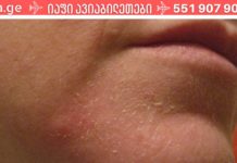 როგორ გავიგოთ, რომ სხეულს მეტი წყალი სჭირდება და როგორ შევივსოთ მისი ნაკლებობა?