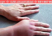 რატომ შუპდება თითები? გაიგეთ ეს 5 შესაძლო მიზეზი და იყავით ყურადღებით!