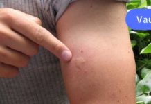 თქვენ ალბათ არ იცით ამ ხრიკების შესახებ, რომლებიც გაგიმარტივებენ ყოველდღიურ ცხოვრებას! აქ არის 16 ფაქტი ჩვენი სხეულის შესახებ!