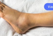 10 ნიშანი, რომელიც მიგანიშნებთ, რომ თირკმელების პრობლემები გაქვთ!