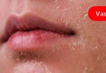 როგორ განვკურნე დაავადებული ღვიძლი ნიორით? უკვე 9 წელია აღარ მახსოვს პრობლემა!