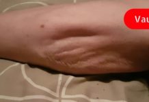 ორგანიზმში დაბალი მაგნიუმის 12 საშიში ნიშანი! გაიგეთ როგორ შეივსოთ მაგნიუმის ნაკლებობა!