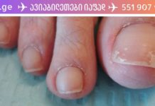 სოკოს წინააღმდეგ ბრძოლის ყველაზე ეფექტური მეთოდები! თქვენ სამუდამოდ დაივიწყებთ ამ პრობლემას!