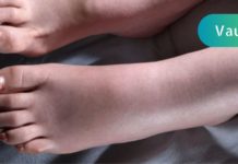 სისხლში მაღალი ქოლესტერინის მანიშნებელი 9 სიმპტომი, რომელიც ძალიან საყურადღებოა! არ უგულებელყოთ ისინი!